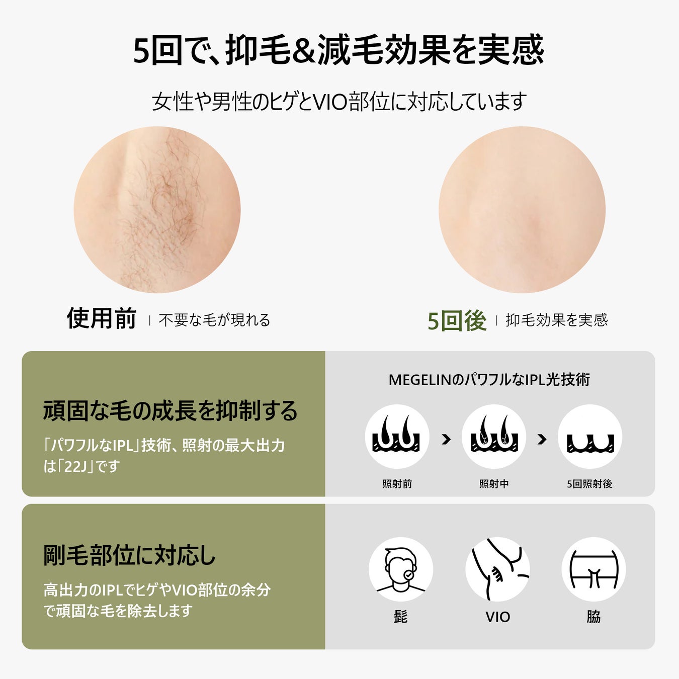 「男性脱毛の福音」MEGELIN MAX POWER脱毛器、新登場!!北米地域で大人気の商品がついに登場しました!のサブ画像3